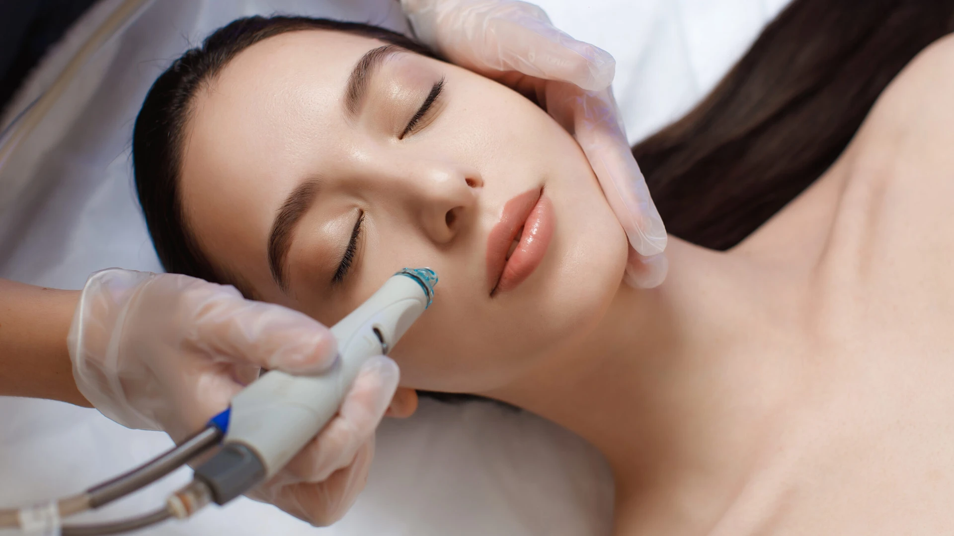 HydraFacial treatment